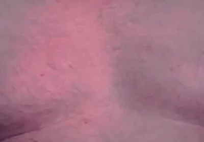 Brust Raus Nippel