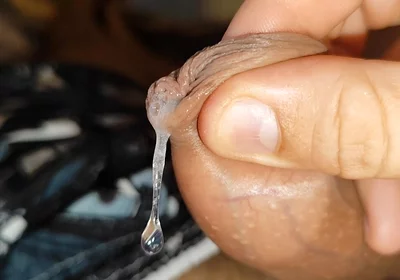Cumshot of the Largest Phimosis Foreskin in the World.