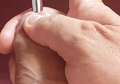 Sounding Strong the Foreskin Between the Trembling Glans.