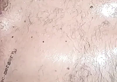 Stillness and Skin