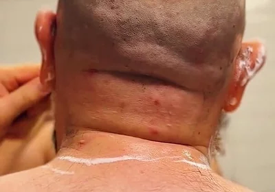 Shave Bald Head and Worship