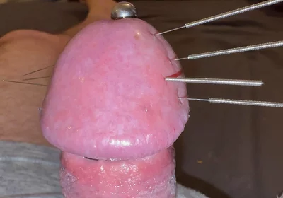 Needles Through the Thick, Hard Glans, Mega Orgasm