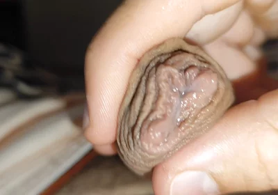 Silent Purge of Straight Scrotal Fluid.