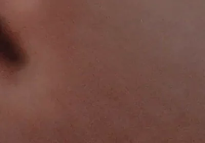 Amazing Closeup of the Widened Hole!!