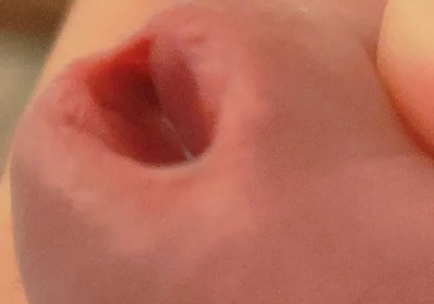 Amazing Closeup of the Widened Hole!!