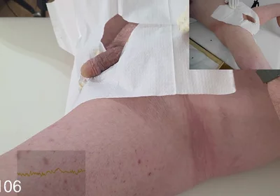 16 French Foley Insertion