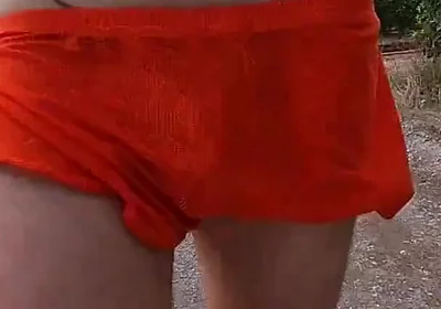 This Is What Happens When I Wear Shorts