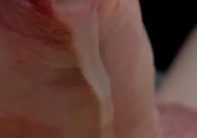 Phimosis Cock Leaking Cum Close-up Hands-free