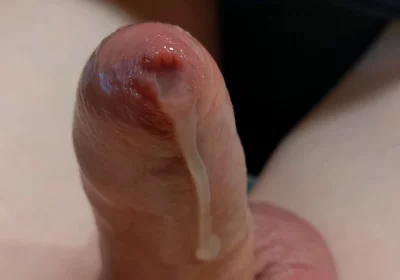 Phimosis Cock Leaking Cum Close-up Hands-free