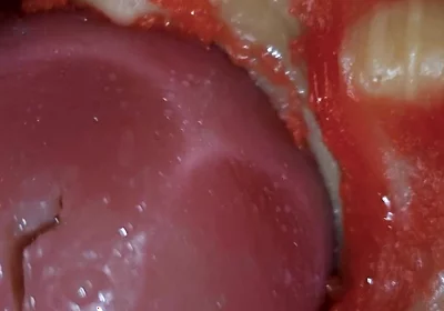 Inside POV Camera Captures an Intense Climax