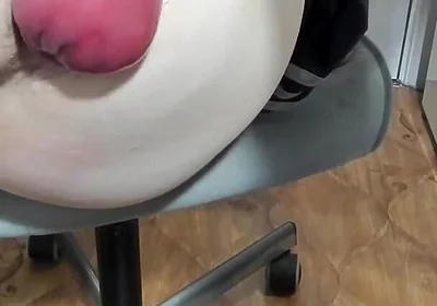 A Piece of Intestine Hangs From a Young Ass