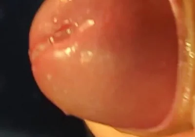 Juicy Close up