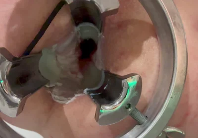 Pouring Hot Candle Wax Into Ass