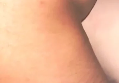 Smooth Skin