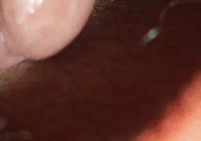 Super Anal
