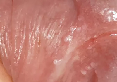 Wide Hole Filled with Pre Cum in Close up