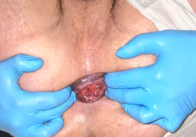 Virgin Asshole Open Anal Compilation Huge Dildo Big Ass