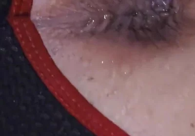 Unleashing the Flood