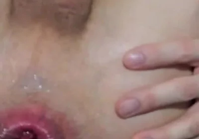 Sexy Thongs, Juicy Ass, and Anal Prolapse with Pump