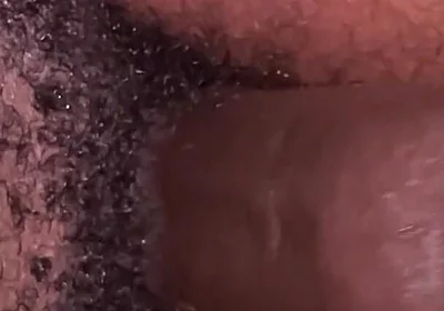 Habesha Dick