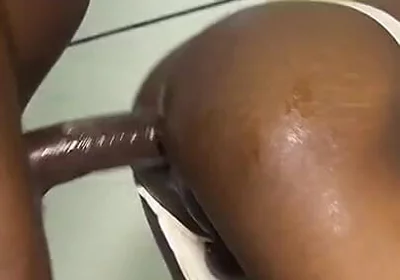 He Damaged His Ass Hole