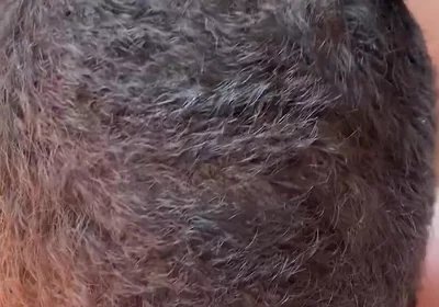 More Sucking