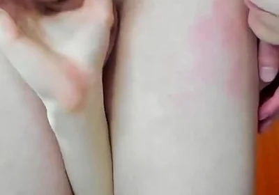 Why Won't Alex Let Me Bite His Leg?