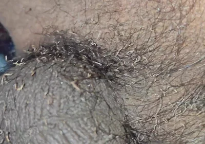 My Bushes Catch Fire Burning Penis Shaved Penis by Fire