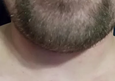 Young Agile Tongue