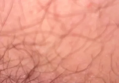 Close up Hairy Hole