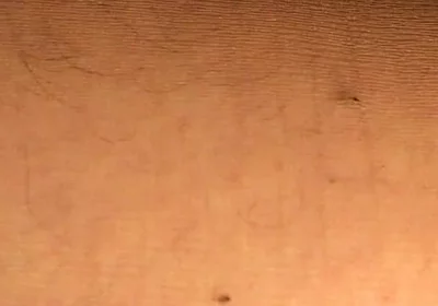 Hard Anal Fisting in Pantyhose