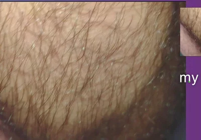 The Texture of the Clothes
