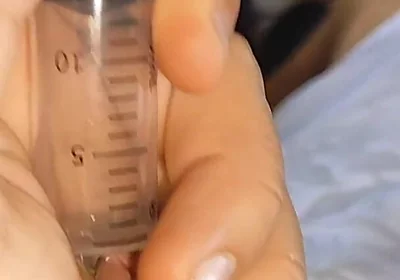 First Hardcore Cum Extraction in Syringe Part 1