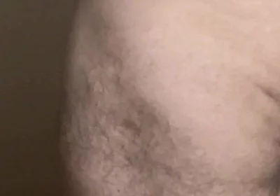 Fat Dick