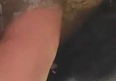 Uncircumcised Phimosis Has the First Ejaculation.