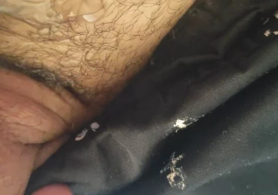 Uncircumcised Phimosis Has the First Ejaculation.
