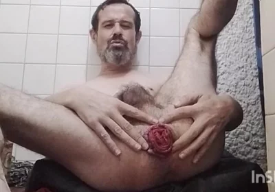My Prolapse April 2026