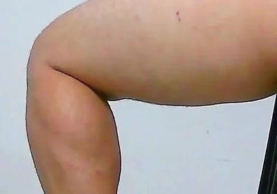 Oh, My Ass Hurts, Apply Ointment
