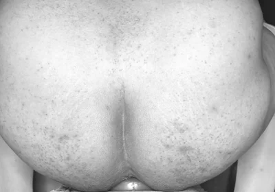 Extreme Anal Plug