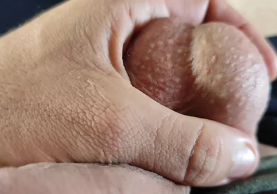 Homemade Stimulator Shoots Electric Shock in the Glans.