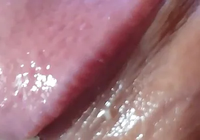 Strange Lumpy Cock with a Gigantic Head.