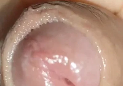 Growth Technique for Soft Cock Sold Out in 30 Seconds.