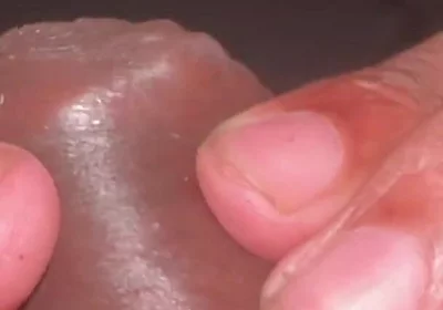 Forskin Play & My Thick Veiny Cock Shooting a Massive Creamy Load