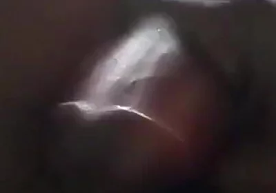Sperm