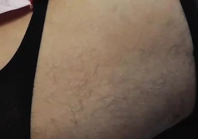 Rot Couch
