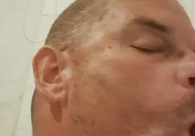 The Greedy Sucking