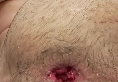 Teen Fisting Gaping Asshole Hard