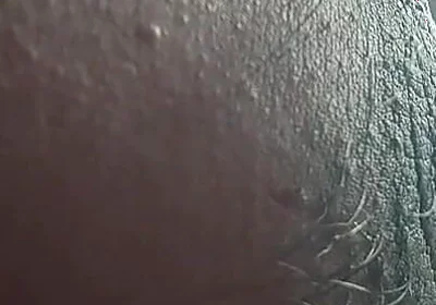 Armpit