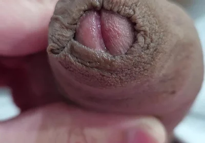 The Head of My Penis