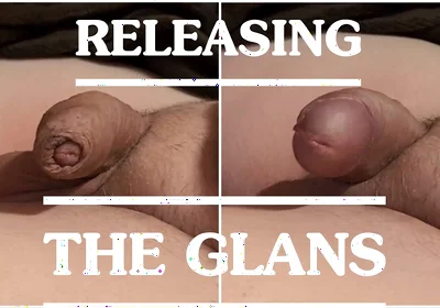 Releasing the Glans From the Foreskin - a Compilation